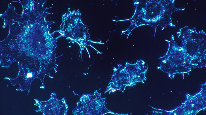 A CURE FOR CANCER? ISRAELI SCIENTISTS SAY THEY THINK THEY FOUND ONE